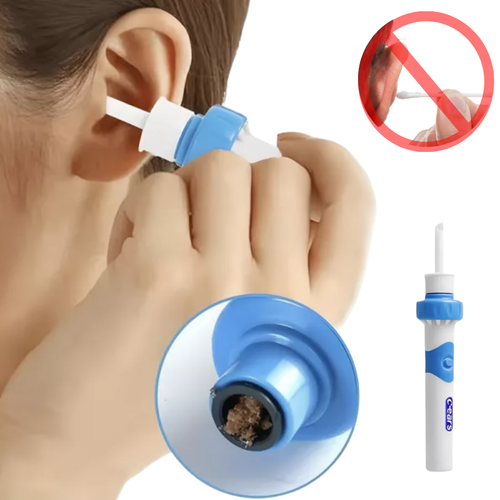 Skanto | Elektrisches Ohrenschmalz-Sauggerät | Ergonomisch, Silikonspitze & kompaktes Design für sichere Ohrenhygiene zu Hause oder auf Reisen