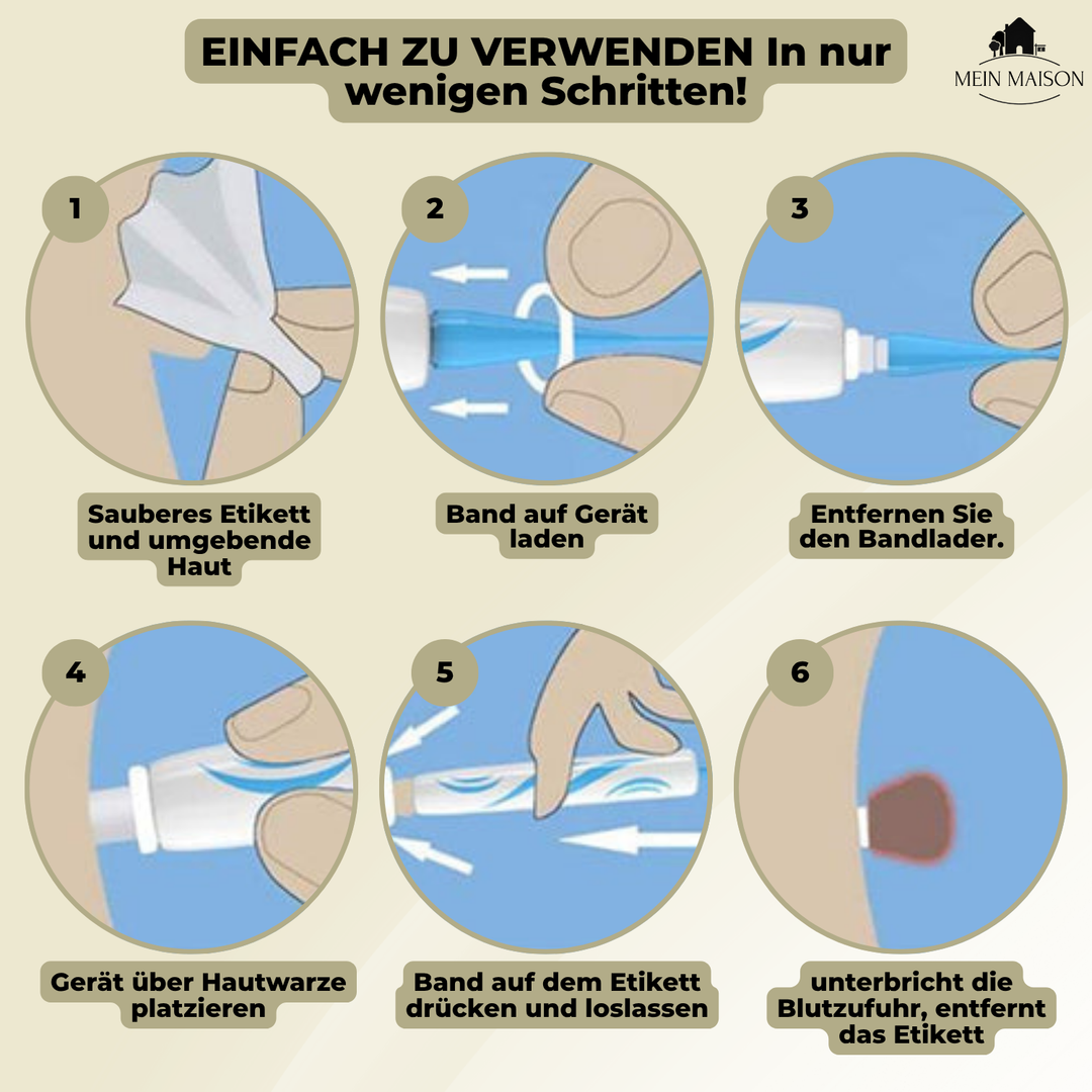 Skanto | DermaLinx Warzenentferner | Schmerzfreie Entfernung von Warzen und Muttermalen | Für den Heimgebrauch | Ohne Operation