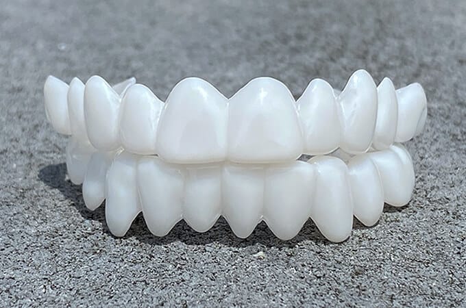 Skanto | Smile Lens – Verstellbare weiße Prothese zur direkten Lächelnkorrektur