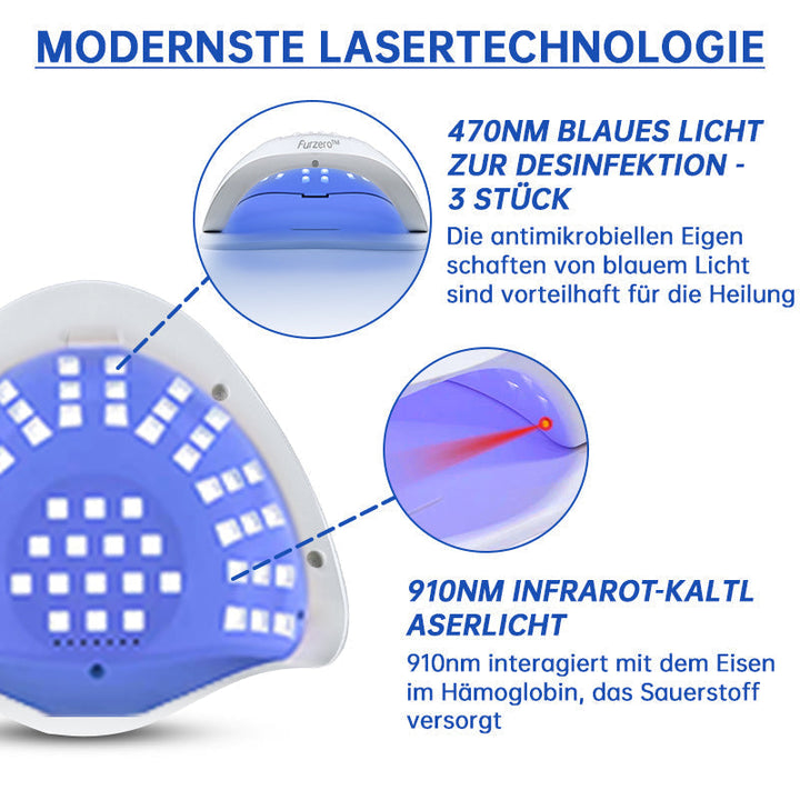 Skanto | PureNail™ | Nagelpfliz-Laserbehandlungsgerät – Ihre Geheimwaffe gegen Nagelpilz