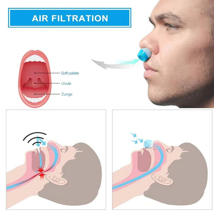 Skanto | Anti-Schnarch-Gerät | Schlauchloses, maskenfreies Micro-CPAP
