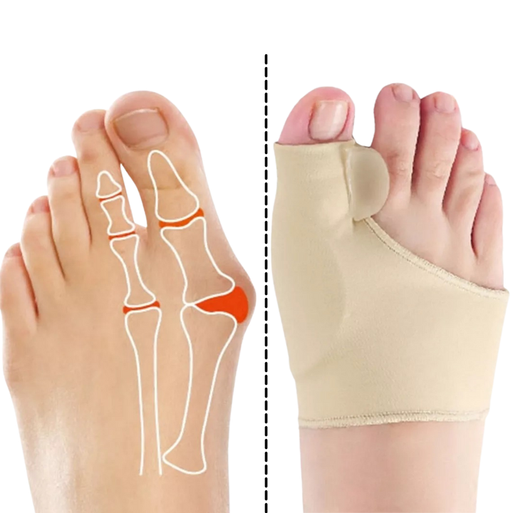 Gel-Hallux-Valgus-Korrektor