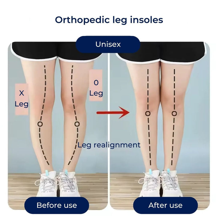 HeelGuard | Fersenschalen aus Silikongel – Linderung von Fersenschmerzen – Stoßdämpfendes Polster – Orthopädische Unterstützung für täglichen Komfort Skanto