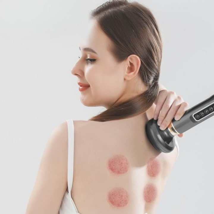 Skanto | Elektrisches Schröpfmassagegerät zur Muskelregeneration