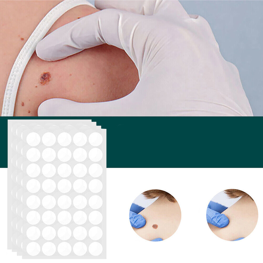 Skanto | SkinClear - Pflaster zur Entfernung von Flecken und Warzen