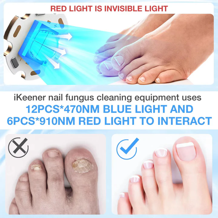 Skanto | Nagelpflanzenlaser