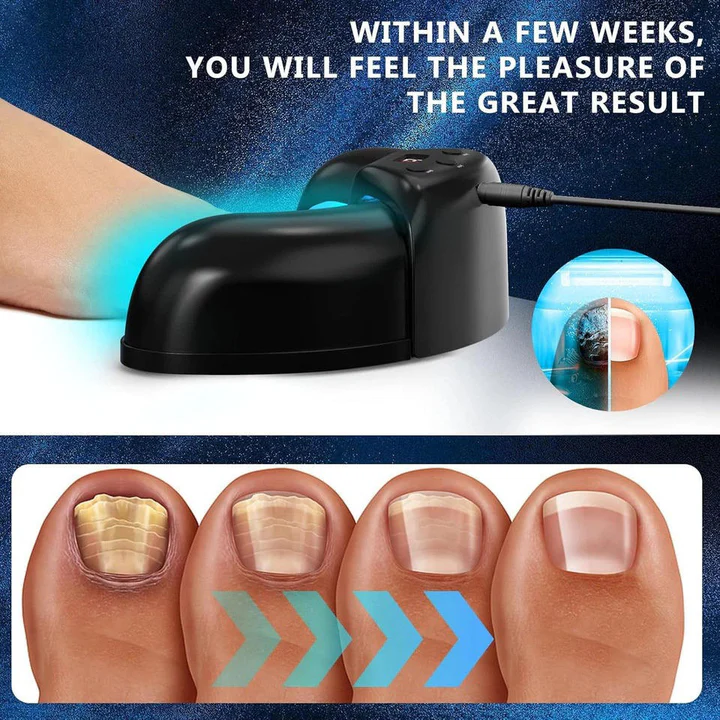 Skanto | Nagelpflanzenlaser