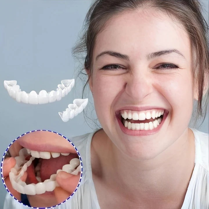 Skanto | Abnehmbare Zahn-Veneers für Ober- und Unterkiefer