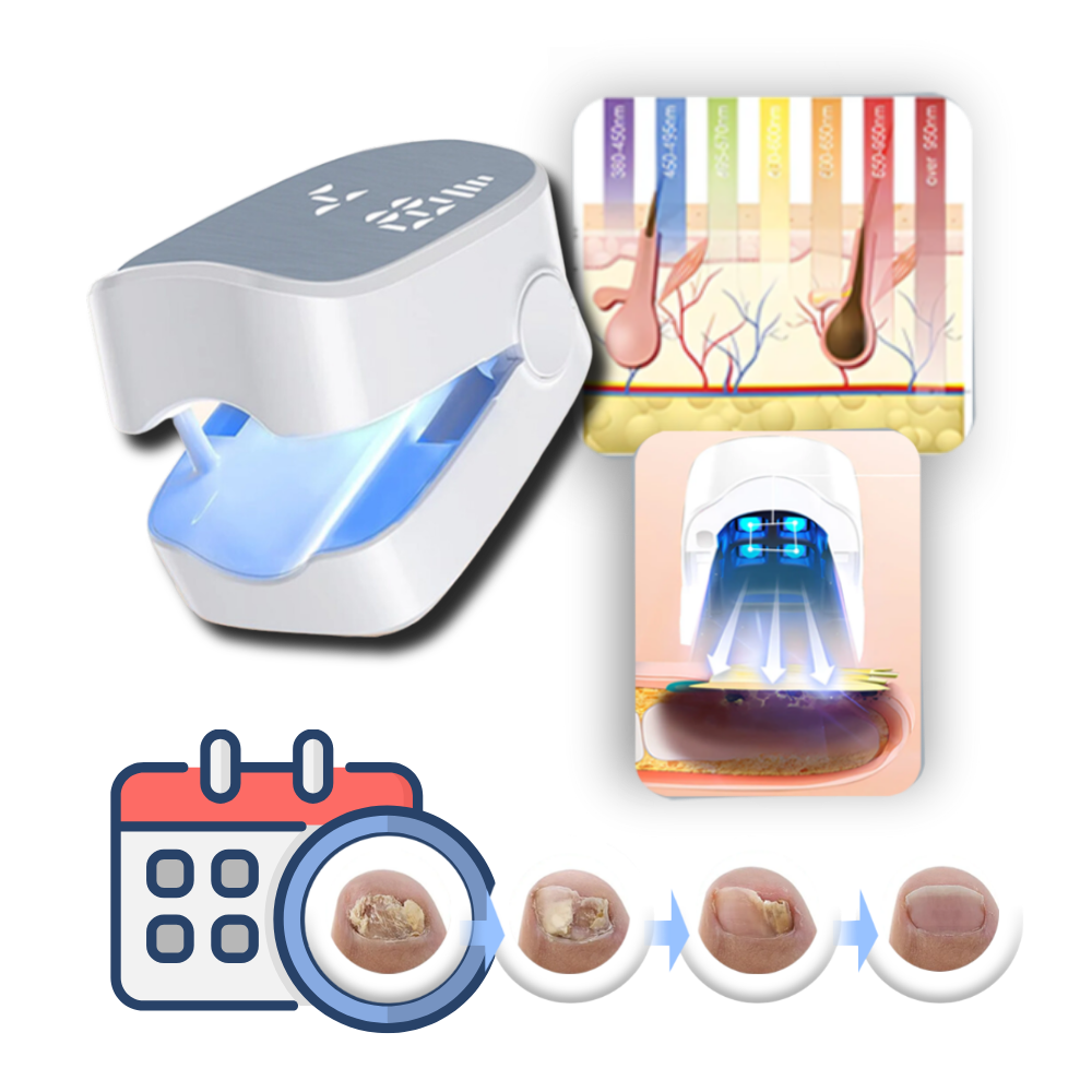 Schmerzloser Nagelpflanzenlaser